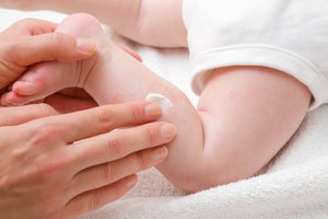 How To Spot And Treat Baby Eczema With Natural Ingredients