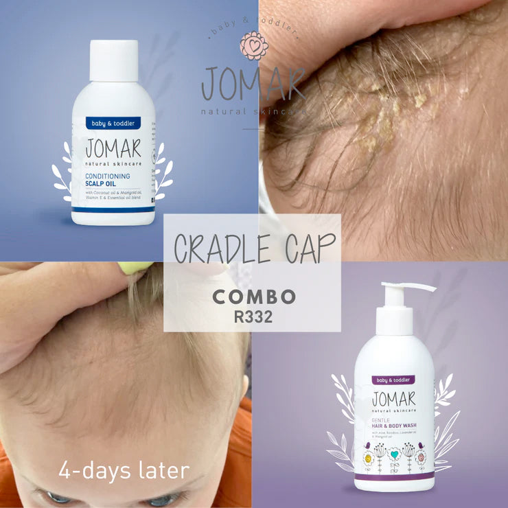 Cradle Cap Combo – JOMAR Natural Skincare