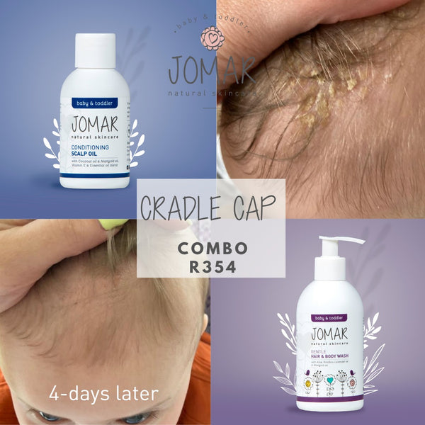Cradle Cap Combo